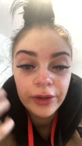 Eyelash Extensions Caused This 21 Year Old Temporary Blindness | #